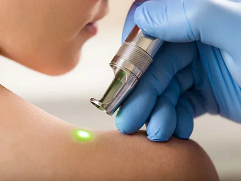 Lasertherapien